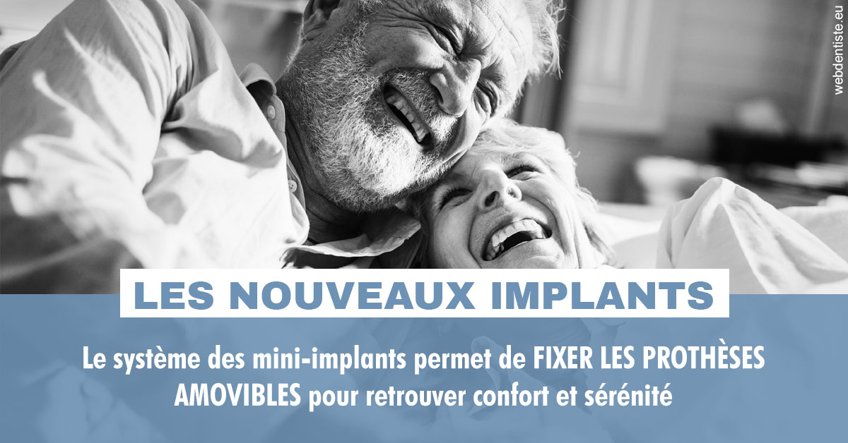 https://dr-fougerais-guillaume.chirurgiens-dentistes.fr/Les nouveaux implants 2