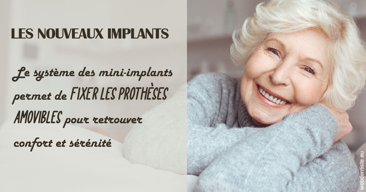https://dr-fougerais-guillaume.chirurgiens-dentistes.fr/Les nouveaux implants 1