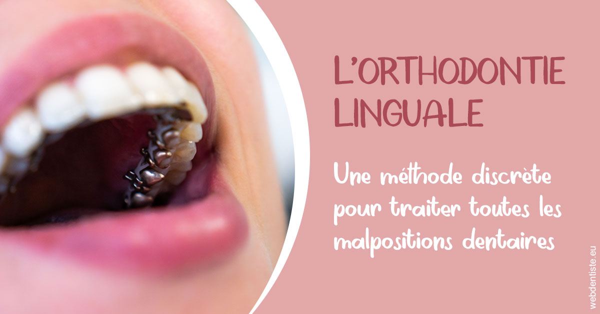 https://dr-fougerais-guillaume.chirurgiens-dentistes.fr/L'orthodontie linguale 2