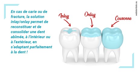 https://dr-fougerais-guillaume.chirurgiens-dentistes.fr/L'INLAY ou l'ONLAY