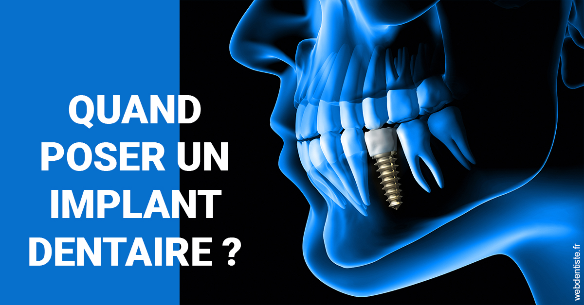 https://dr-fougerais-guillaume.chirurgiens-dentistes.fr/Les implants 1