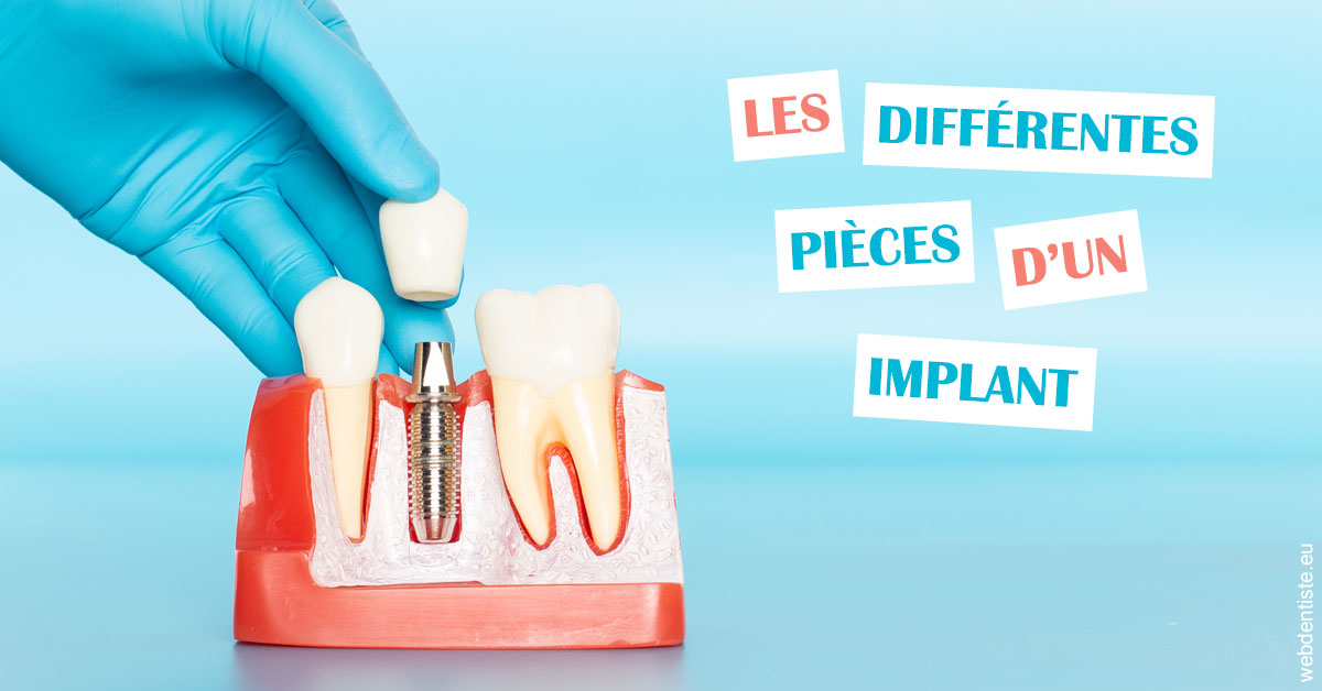 https://dr-fougerais-guillaume.chirurgiens-dentistes.fr/Les différentes pièces d’un implant 2