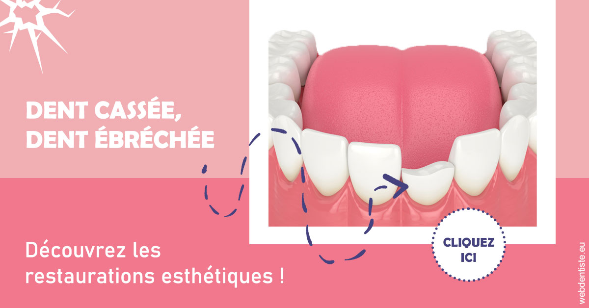 https://dr-fougerais-guillaume.chirurgiens-dentistes.fr/Dent cassée ébréchée 1