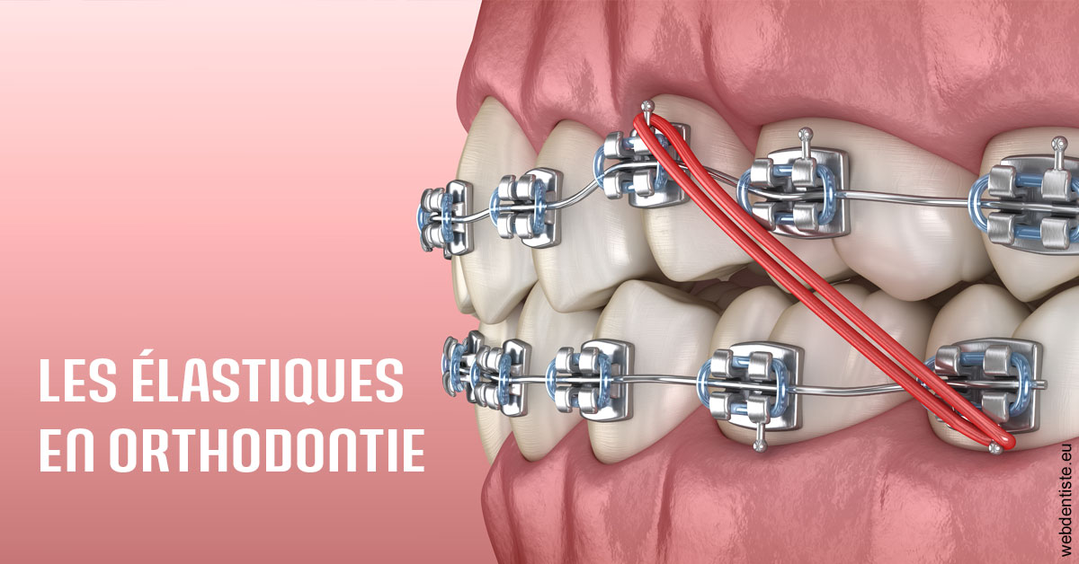 https://dr-fougerais-guillaume.chirurgiens-dentistes.fr/Elastiques orthodontie 2