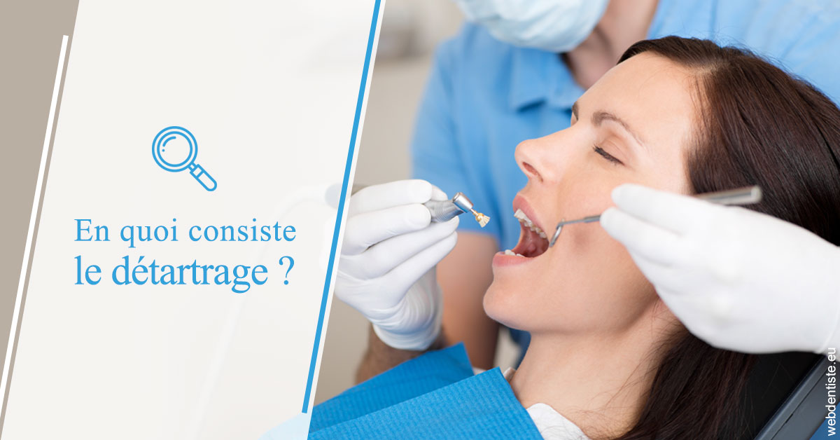 https://dr-fougerais-guillaume.chirurgiens-dentistes.fr/En quoi consiste le détartrage