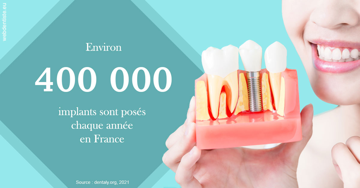 https://dr-fougerais-guillaume.chirurgiens-dentistes.fr/Pose d'implants en France 2